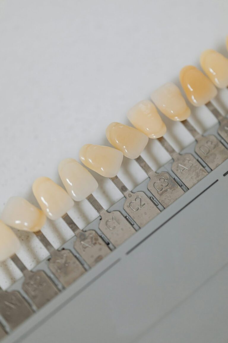 O poder do branqueamento dentário