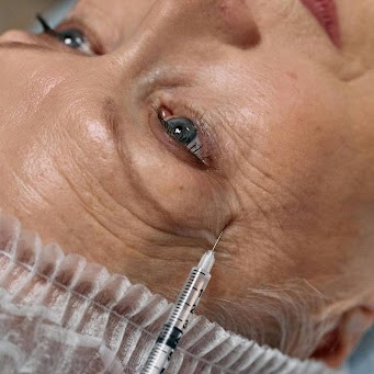 Bioestimuladores de colagénio: o que são e como funcionam?